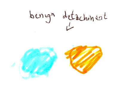 Benign Detatchment